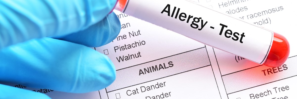 Allergiediagnostik
